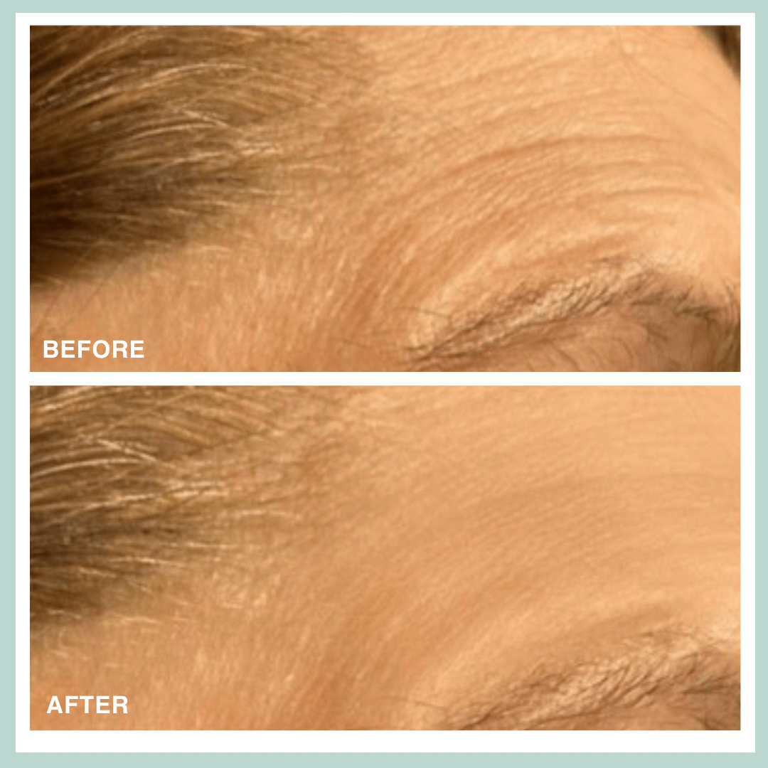 Contours Rx PRODUCTS Microcrystal Patch