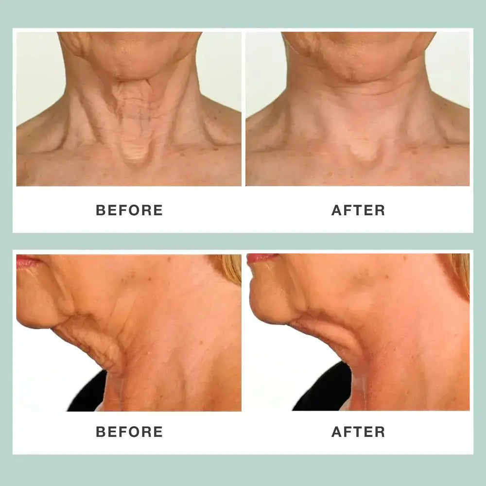 Contours Rx PRODUCTS Neck Rescue