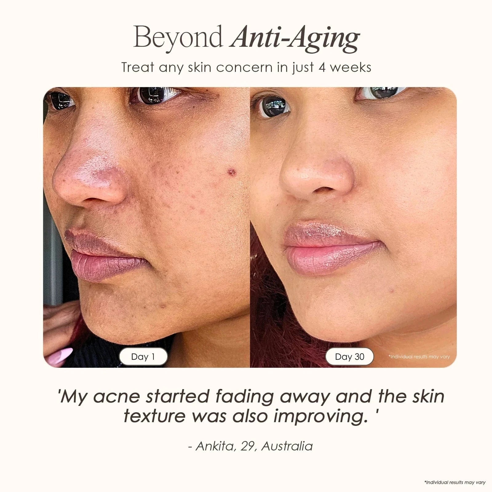 Transform your skincare routine with the Faisca High Frequency Wand Skincare for acne and anti-aging, using neon and argon technology for at-home care.