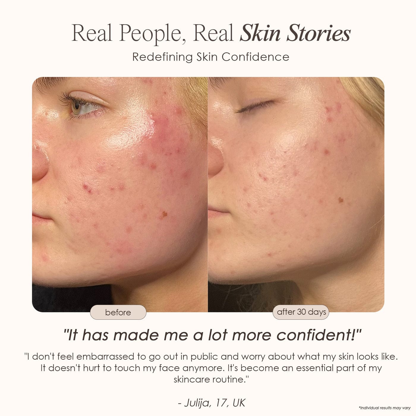 Shop LightAura LED Face Mask at Reverie Luxe. Advanced red & blue light therapy for glowing, youthful skin. Clinically proven results, shop now.