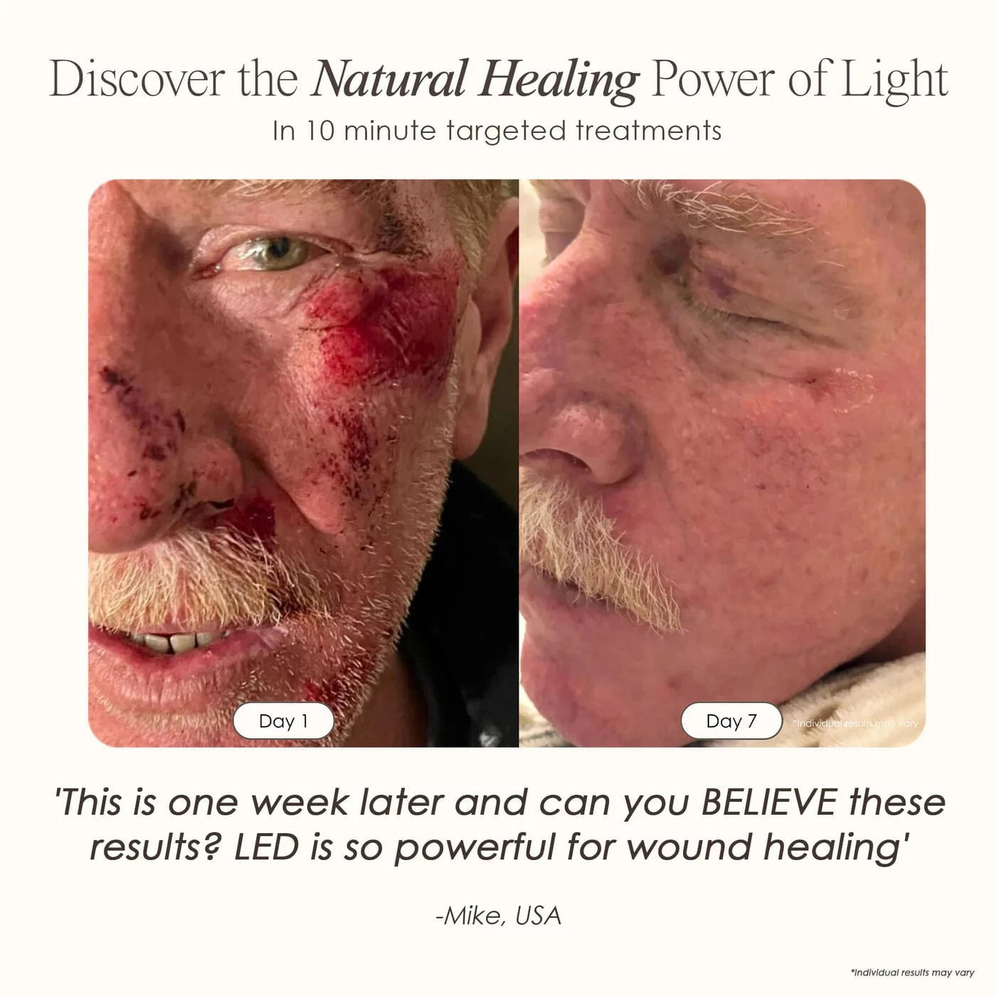 Shop LumaLux Dome LED Light Therapy Device at Reverie Luxe. Red & blue light for skin rejuvenation, acne, anti-aging & body healing. Free UK shipping.