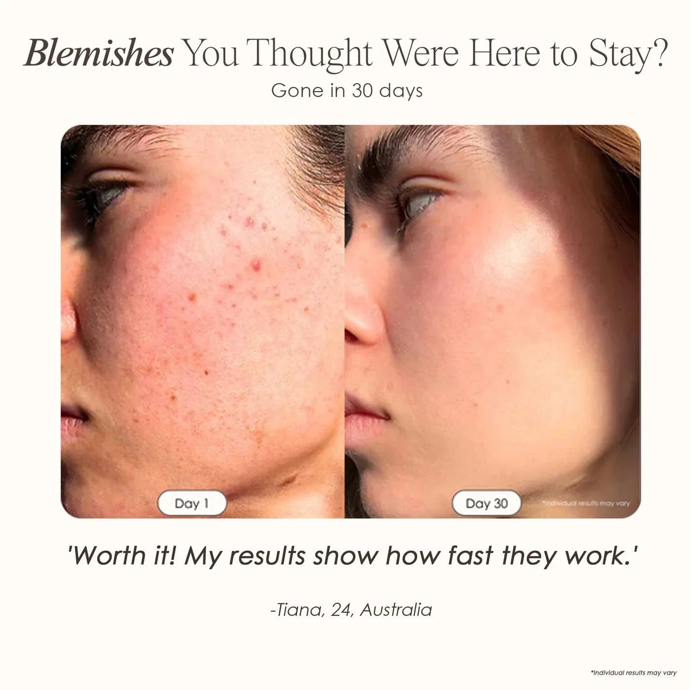 Shop LumaLux Dome LED Light Therapy Device at Reverie Luxe. Red & blue light for skin rejuvenation, acne, anti-aging & body healing. Free UK shipping.