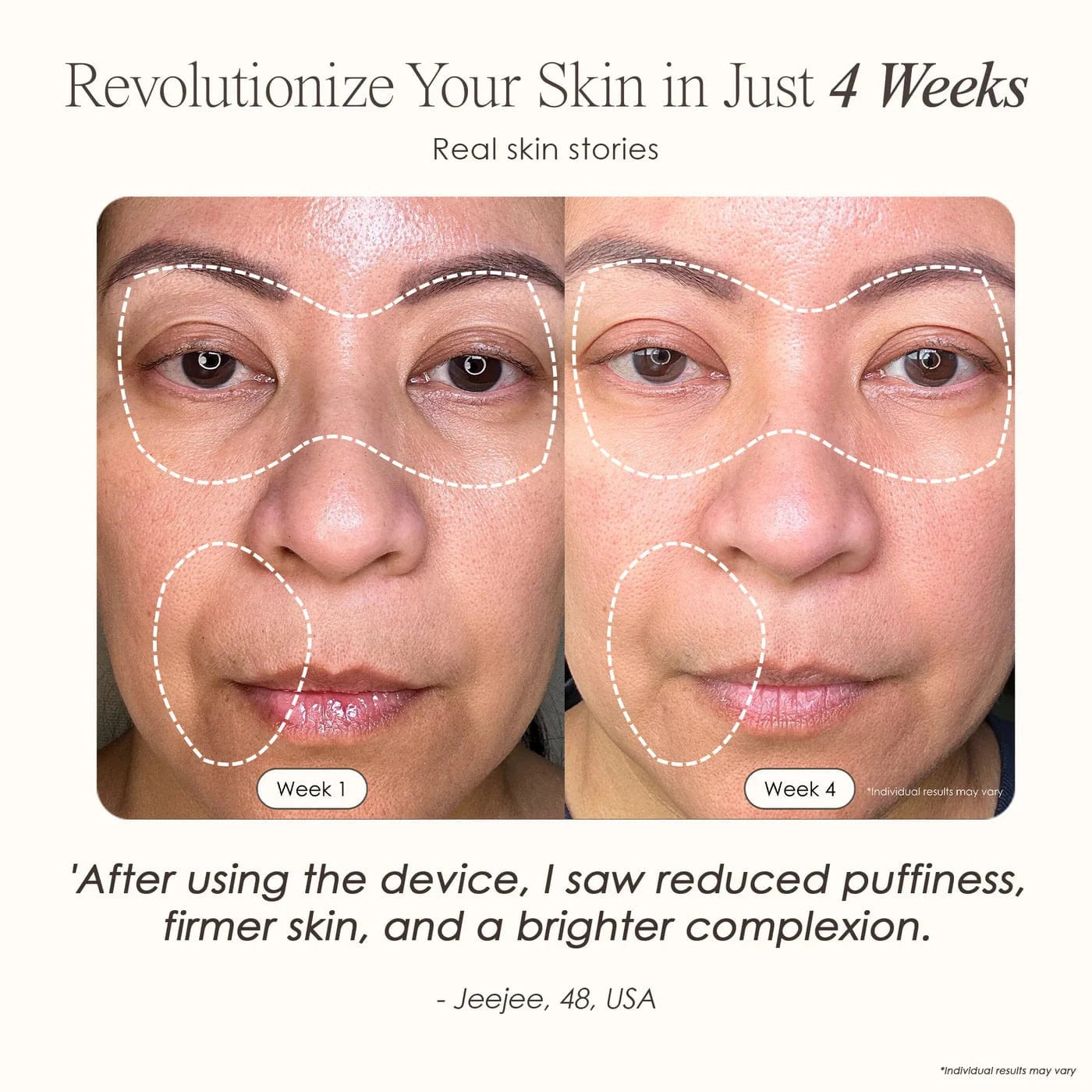 Shop LumaLux Face Pro LED Light Therapy Mask for anti-aging & acne care. Boost collagen, clear skin & glow naturally. Free UK shipping. Order now!