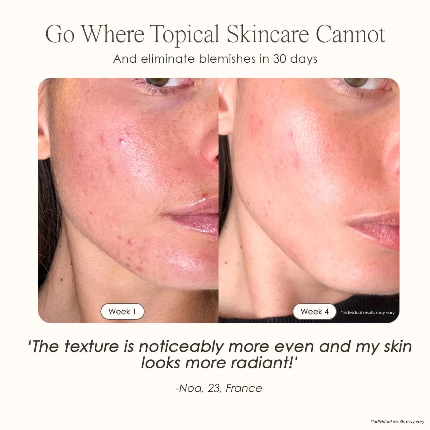 Shop LumaLux Face Pro LED Light Therapy Mask for anti-aging & acne care. Boost collagen, clear skin & glow naturally. Free UK shipping. Order now!