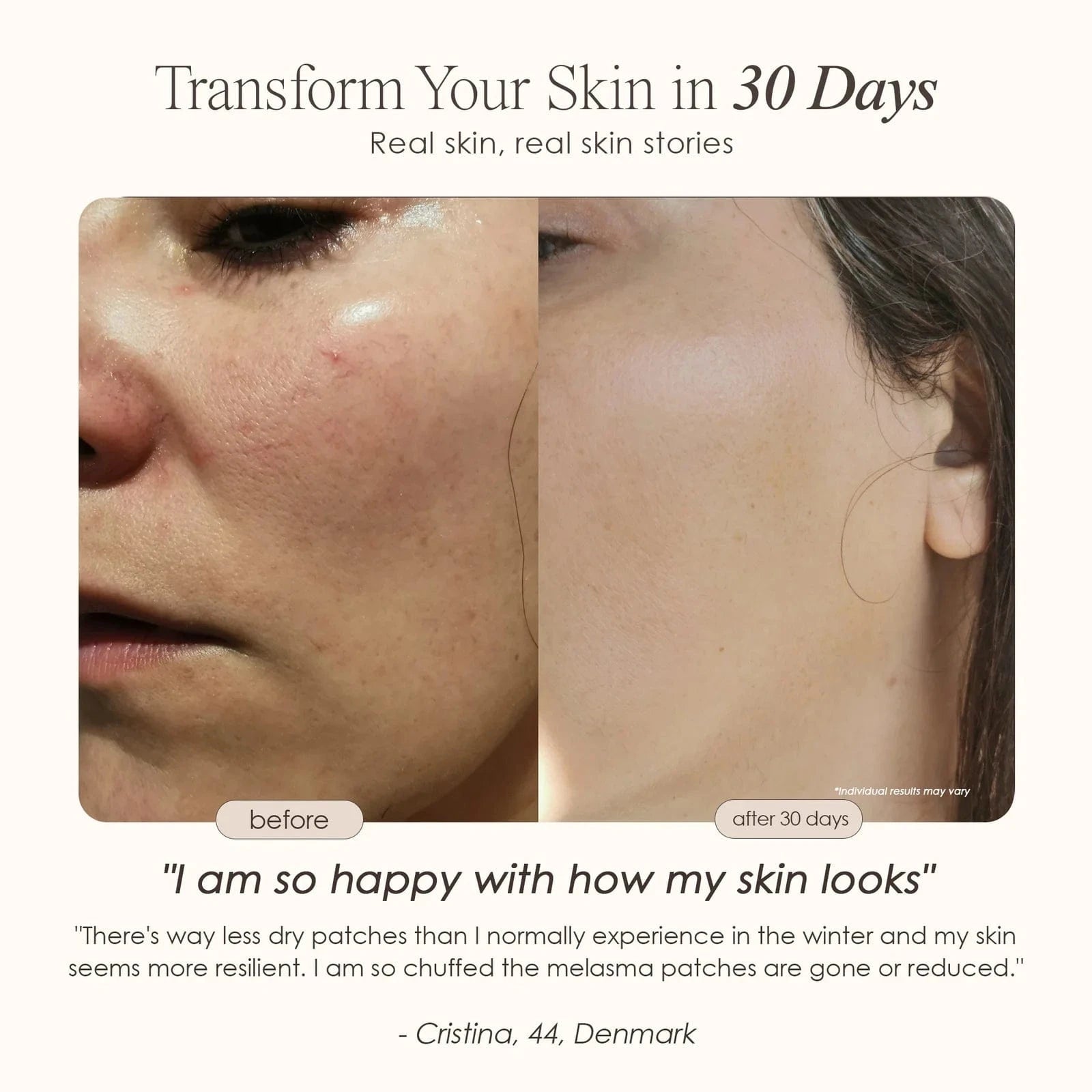 Transform your skin with Lumamask 7 LED Light Therapy Face Mask. Clinically proven light wavelengths target acne, wrinkles & dullness for radiant skin at home.