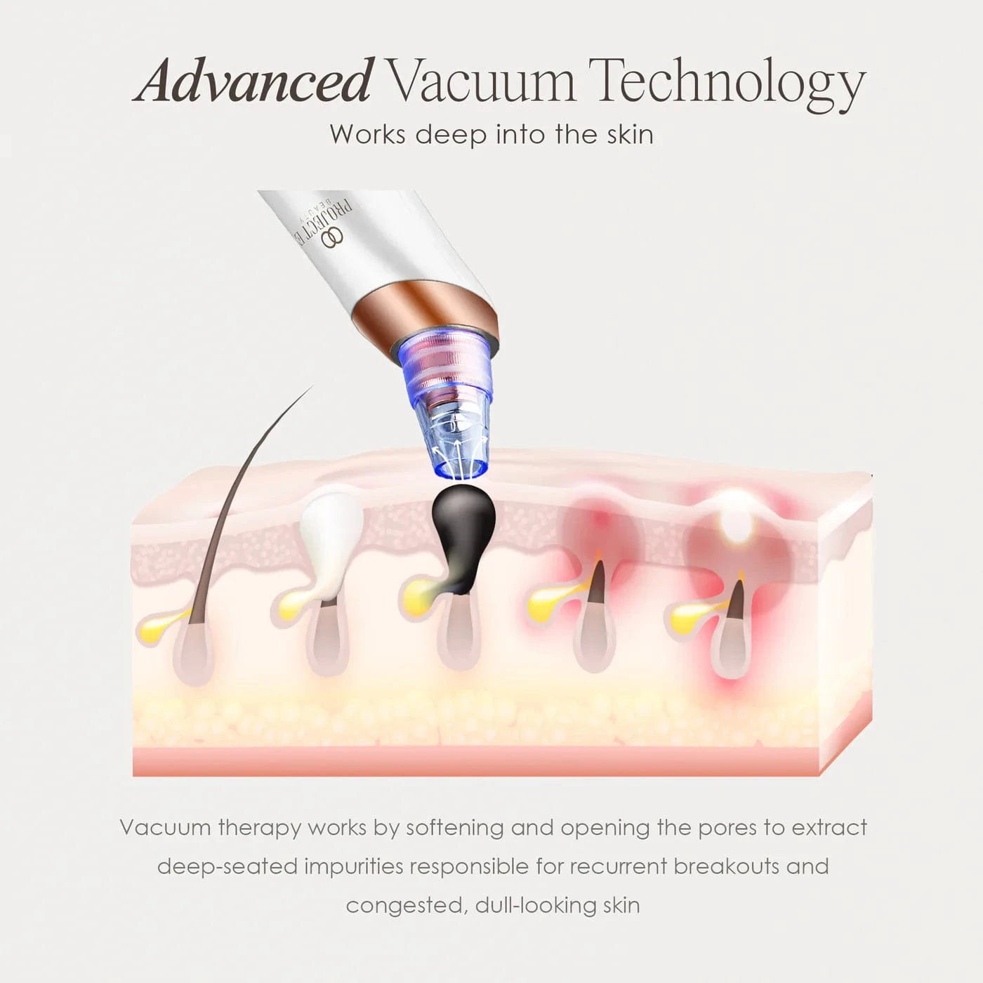 Transform your skincare with the Vana Blackhead Removal Vacuum. Effectively remove blackheads and minimize pores for a clearer complexion at home.