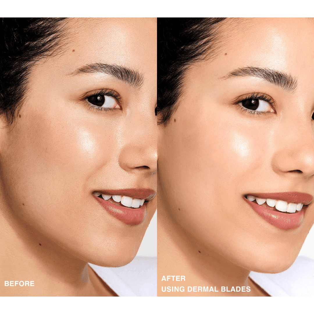 Contours Rx PRODUCTS Dermal Blades