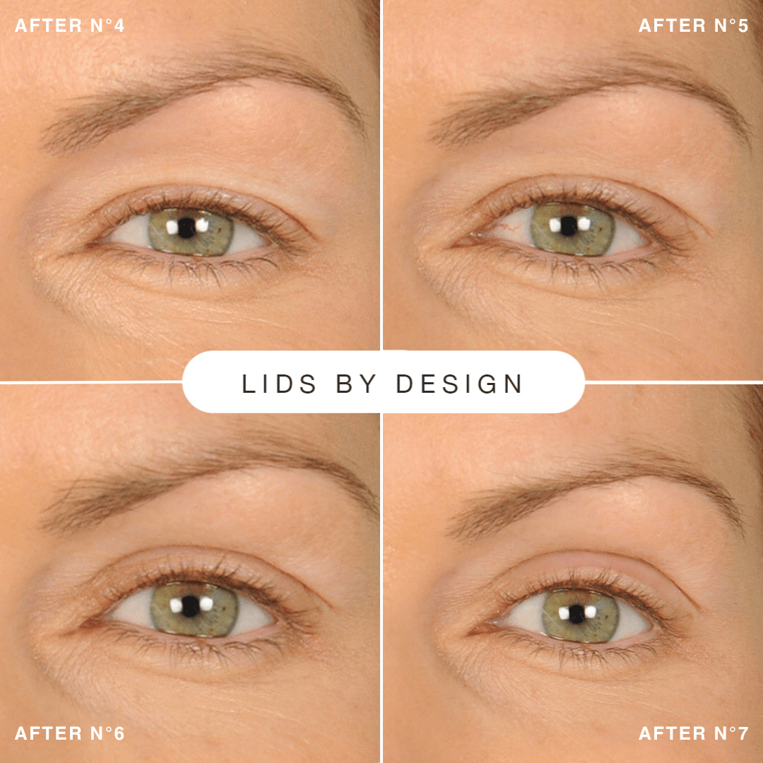 Contours Rx PRODUCTS Lids By Design Assortment Pack