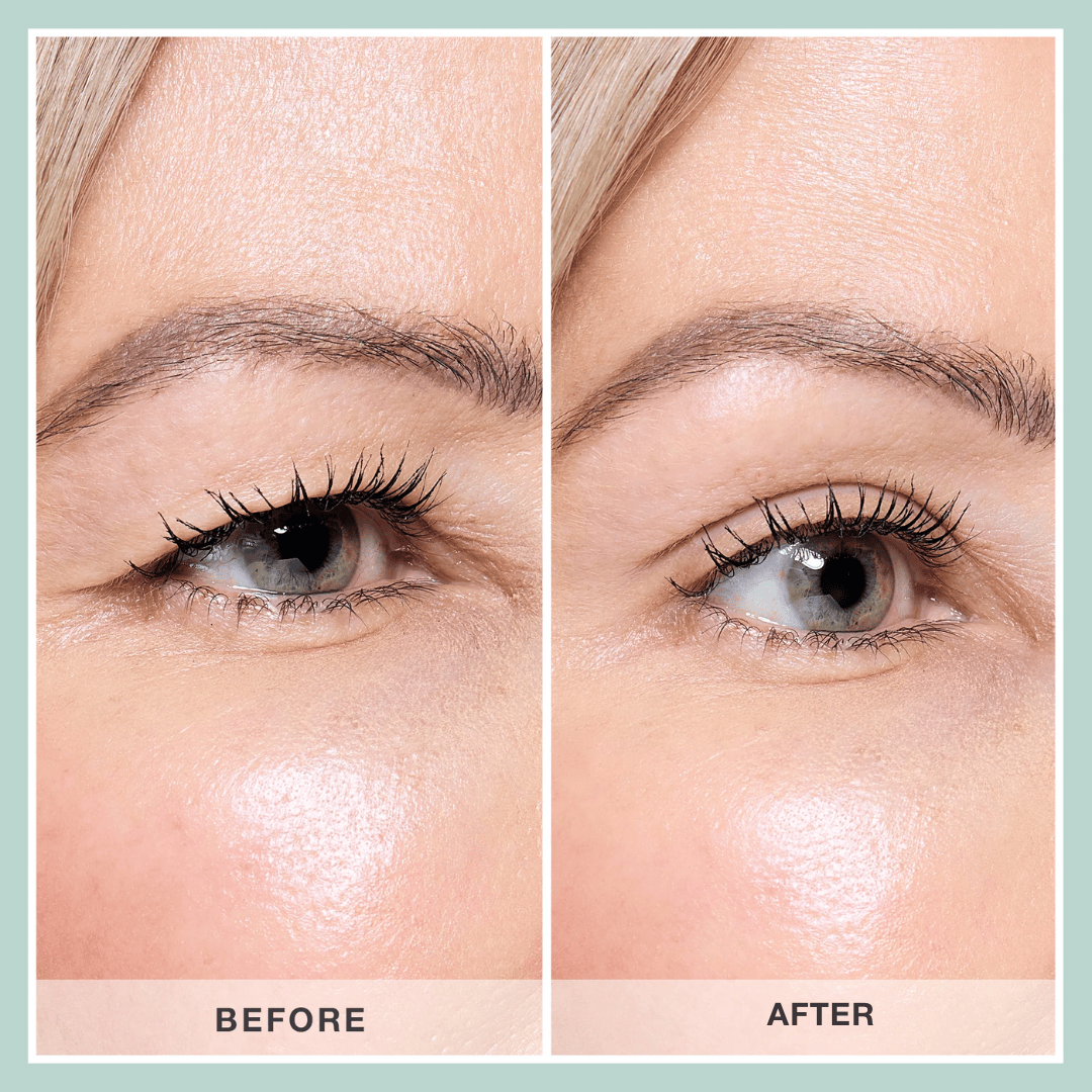 Contours Rx PRODUCTS Lids By Design Assortment Pack