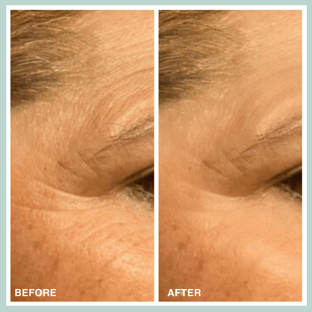 Contours Rx PRODUCTS Microcrystal Patch