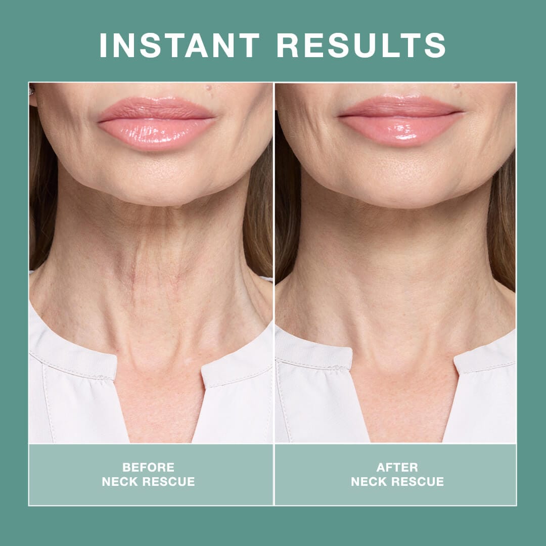 Instant results of Neck Rescue - Neck Pain Relief Device with visible neck tightening and smoother skin on a middle-aged woman.