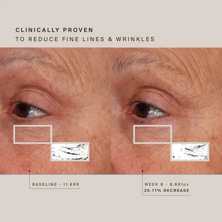 Achieve glowing skin with our Red Light Therapy Face Mask. Improve collagen, reduce fine lines, and soothe redness. Enjoy wearable, wireless comfort and flexible fit.