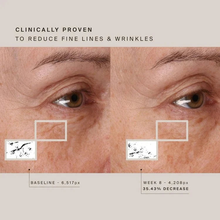 Achieve glowing skin with our Red Light Therapy Face Mask. Improve collagen, reduce fine lines, and soothe redness. Enjoy wearable, wireless comfort and flexible fit.