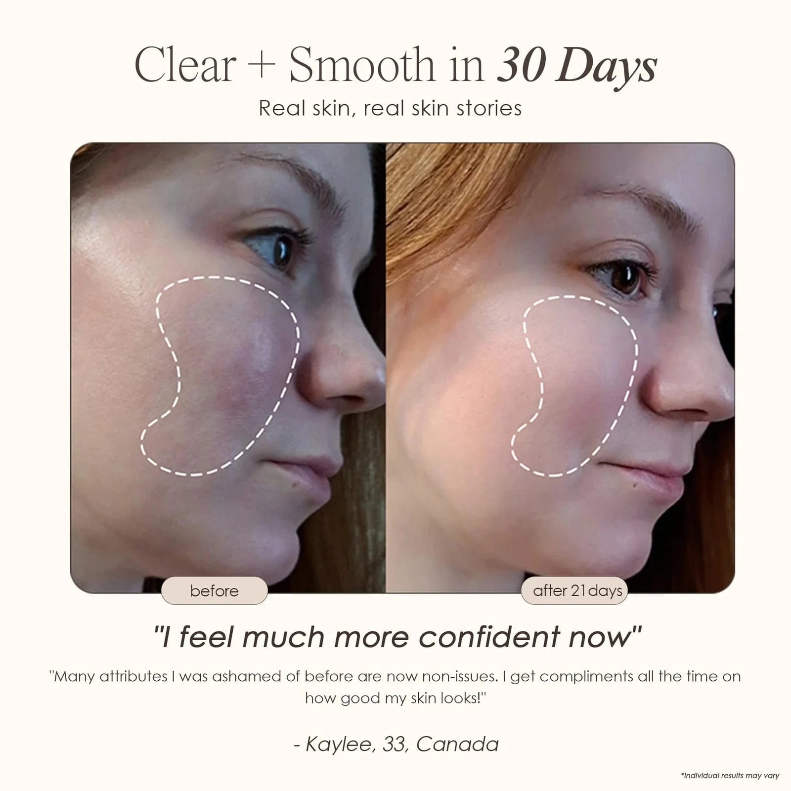 Transform your skincare routine with the Faisca High Frequency Wand Skincare for acne and anti-aging, using neon and argon technology for at-home care.