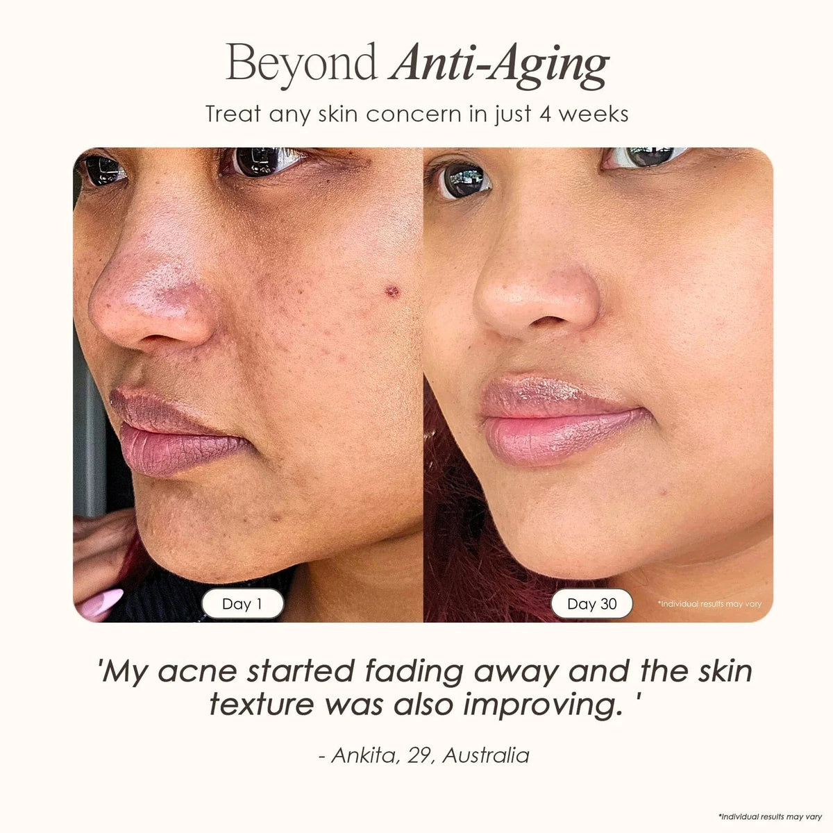 Transform your skincare routine with the Faisca High Frequency Wand Skincare for acne and anti-aging, using neon and argon technology for at-home care.