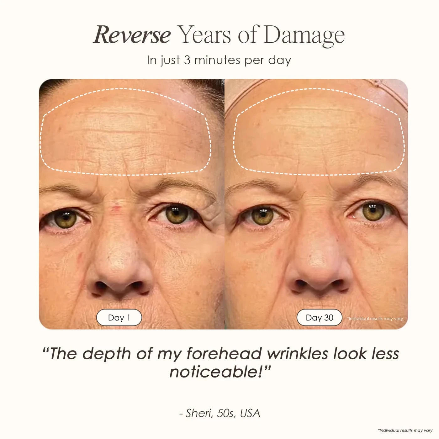 Shop LumaLux Face Pro LED Light Therapy Mask for anti-aging & acne care. Boost collagen, clear skin & glow naturally. Free UK shipping. Order now!