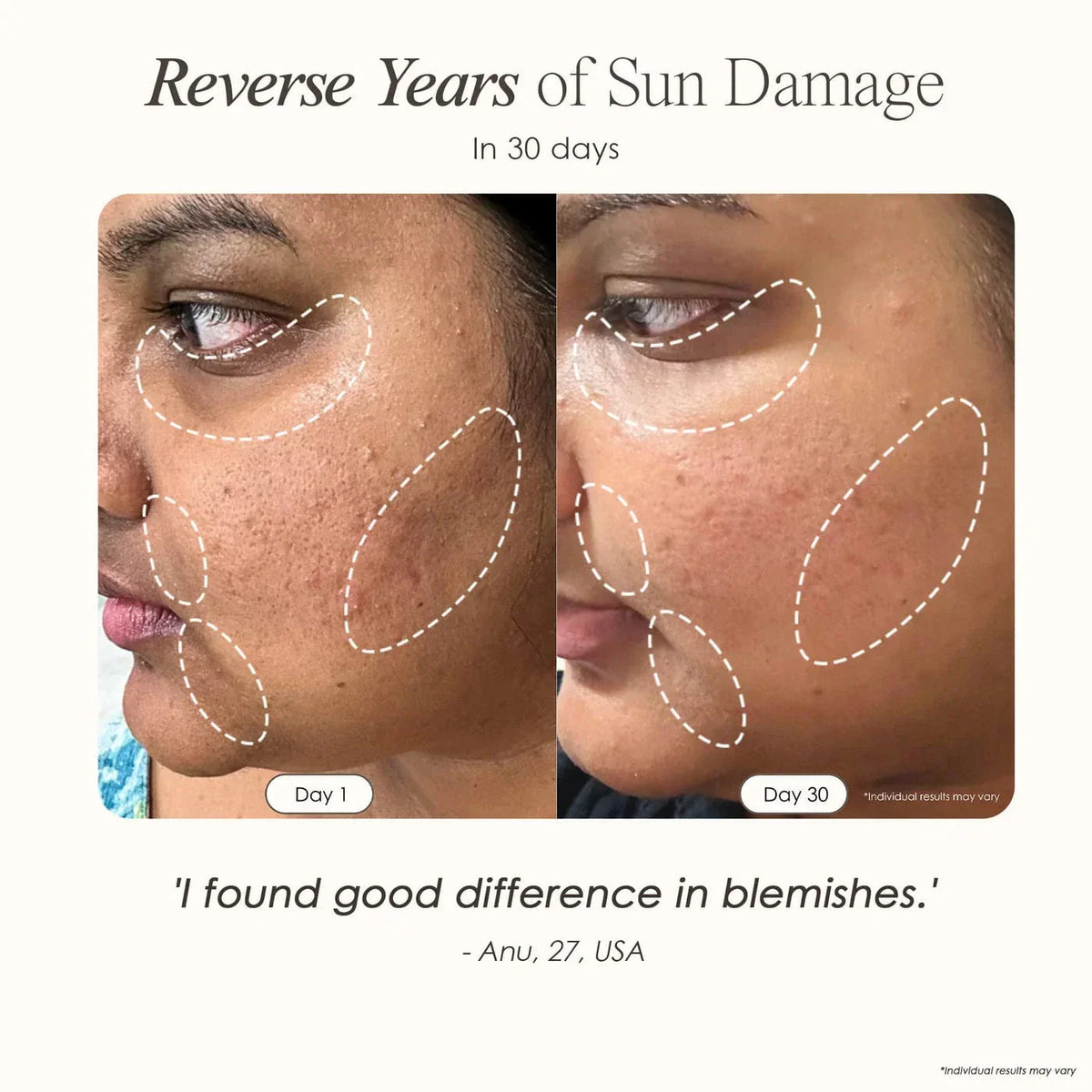 "Get glowing skin with Lumamask Pro LED Light Therapy Mask. Targets acne, fine lines & wrinkles for youthful, radiant skin. Shop professional skincare at home."