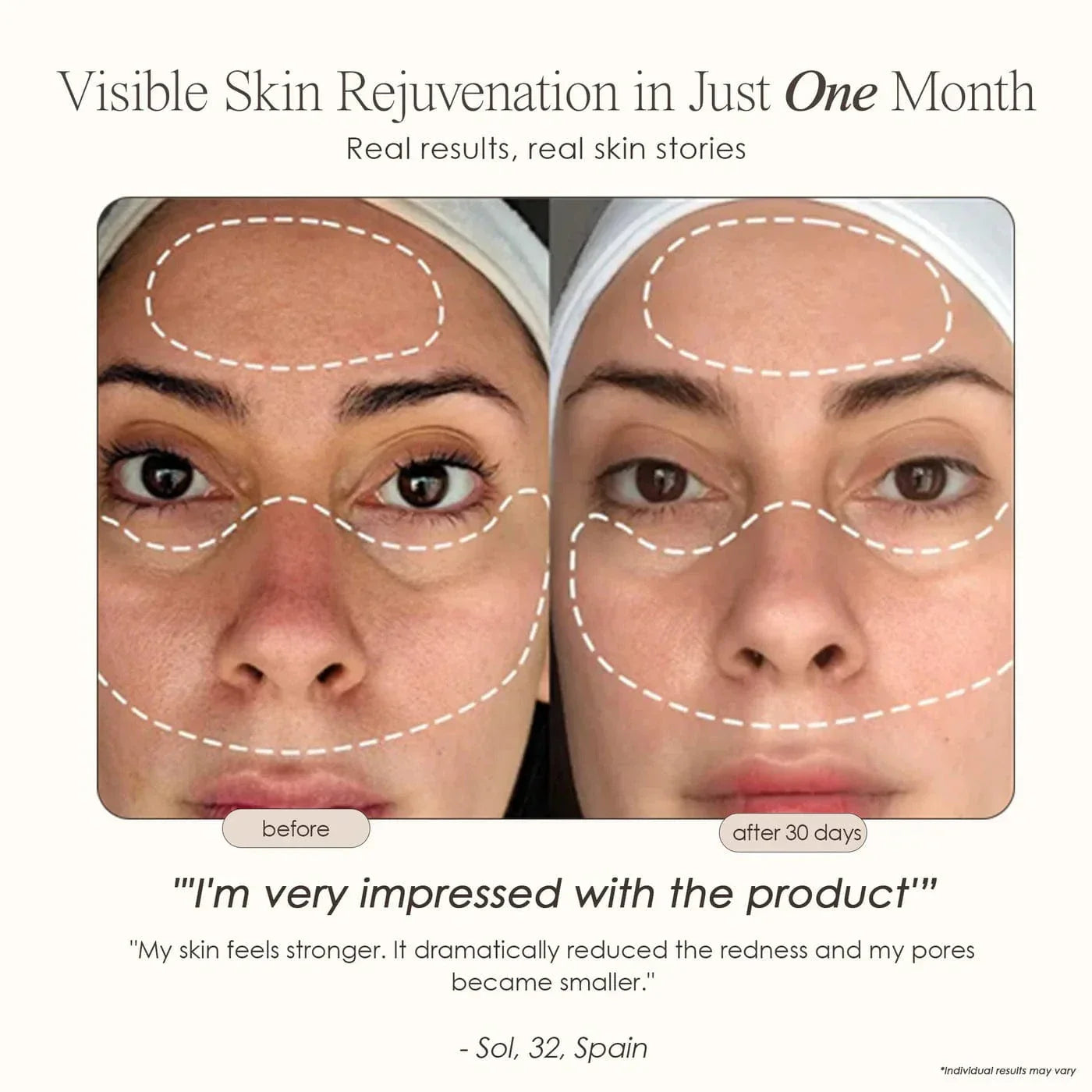 Lumamask Pro | LED Light Therapy Face Mask Skin Care Project E Beauty project-e-beauty-skin-care-lumamask-pro-led-light-therapy-face-mask-1158719723