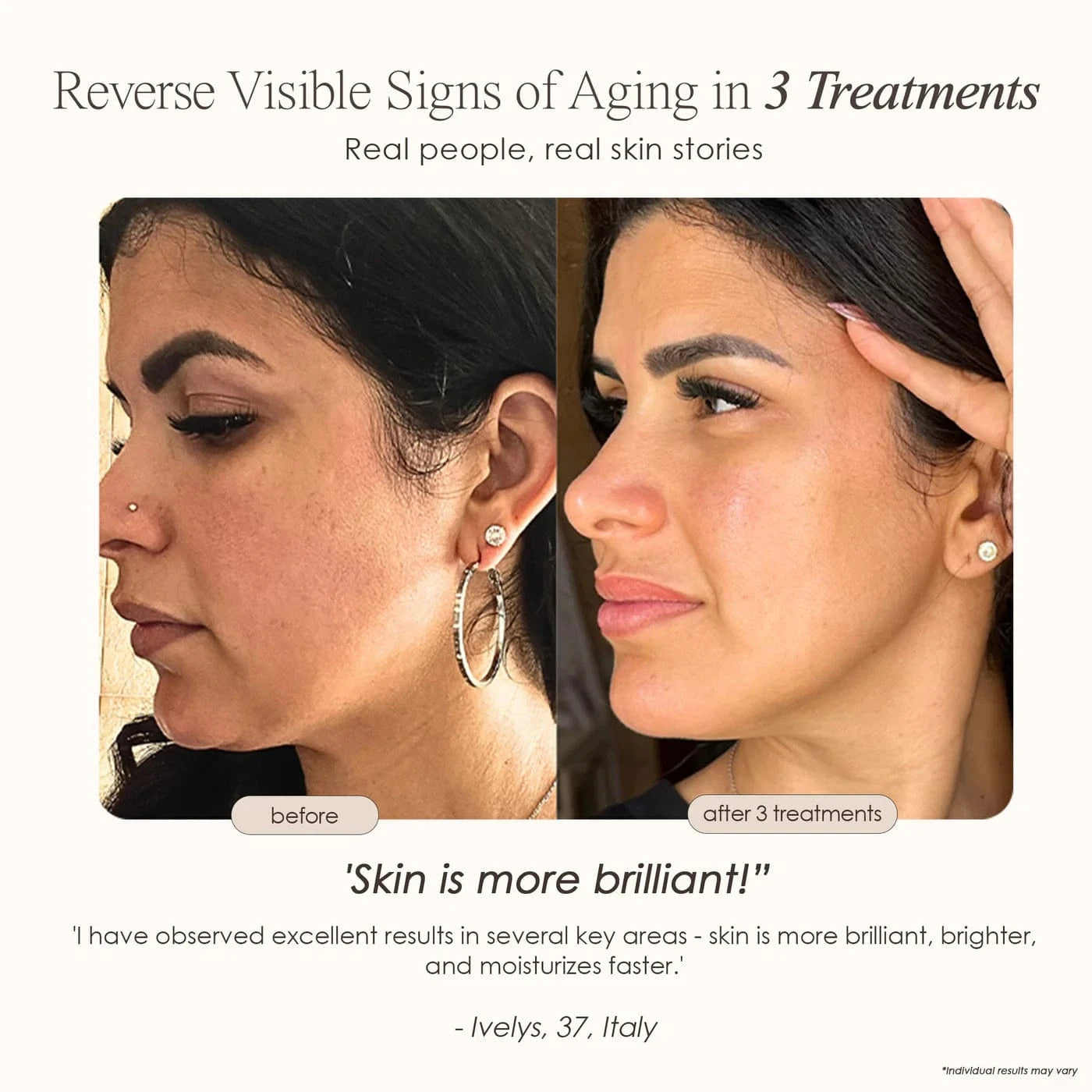 "Reduce wrinkles, firm skin & restore radiance with REVA Instant Age Renewal Wand. Portable anti-aging skincare tool delivering visible results at home."