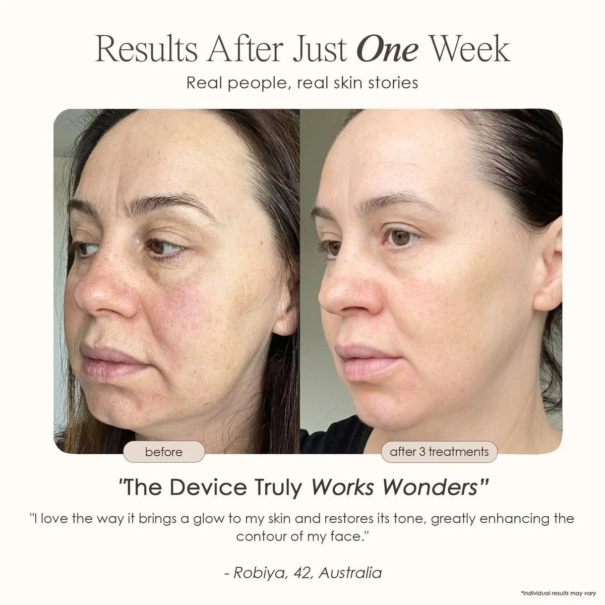 "Reduce wrinkles, firm skin & restore radiance with REVA Instant Age Renewal Wand. Portable anti-aging skincare tool delivering visible results at home."