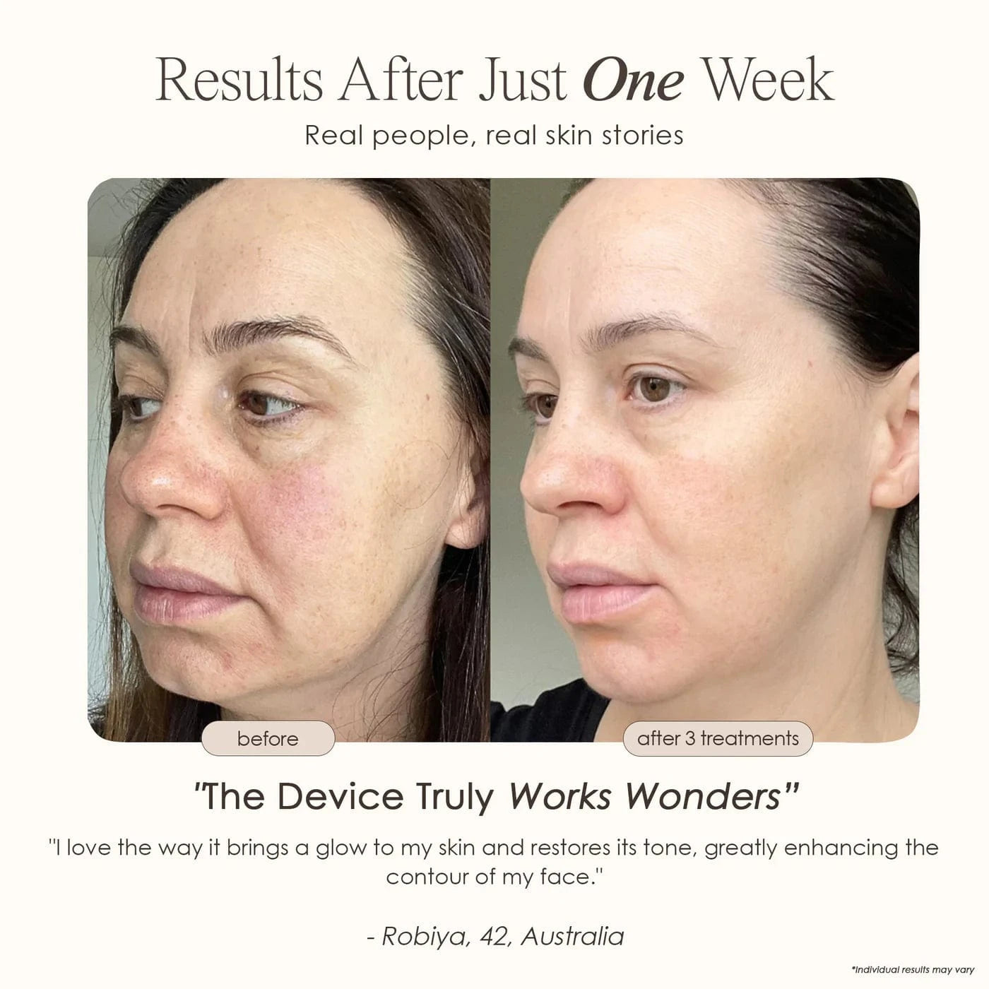 "Reduce wrinkles, firm skin & restore radiance with REVA Instant Age Renewal Wand. Portable anti-aging skincare tool delivering visible results at home."