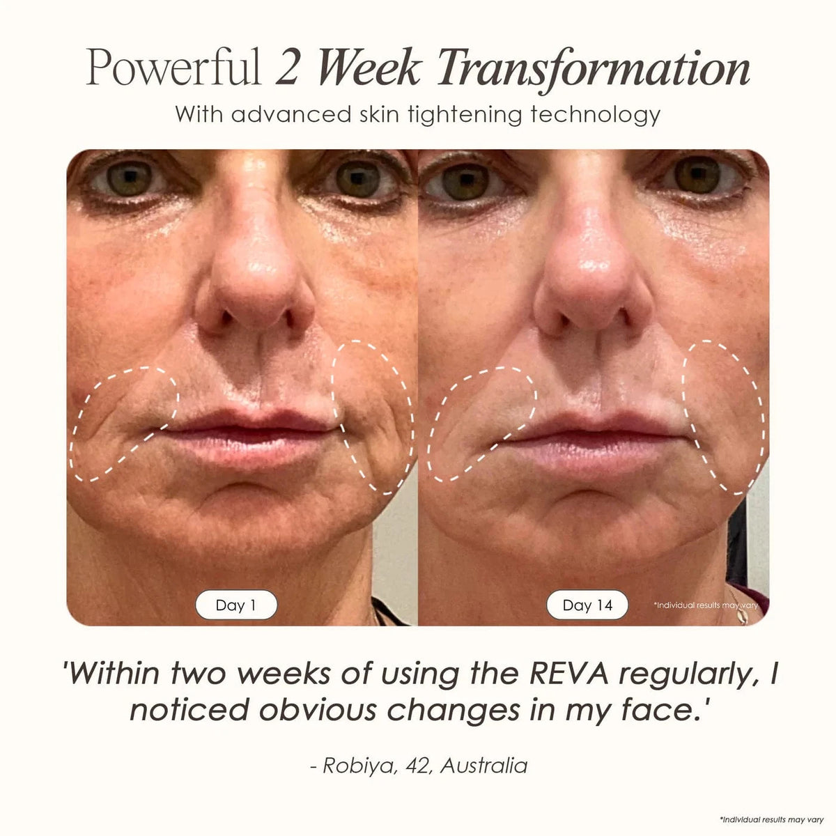 "Reduce wrinkles, firm skin & restore radiance with REVA Instant Age Renewal Wand. Portable anti-aging skincare tool delivering visible results at home."