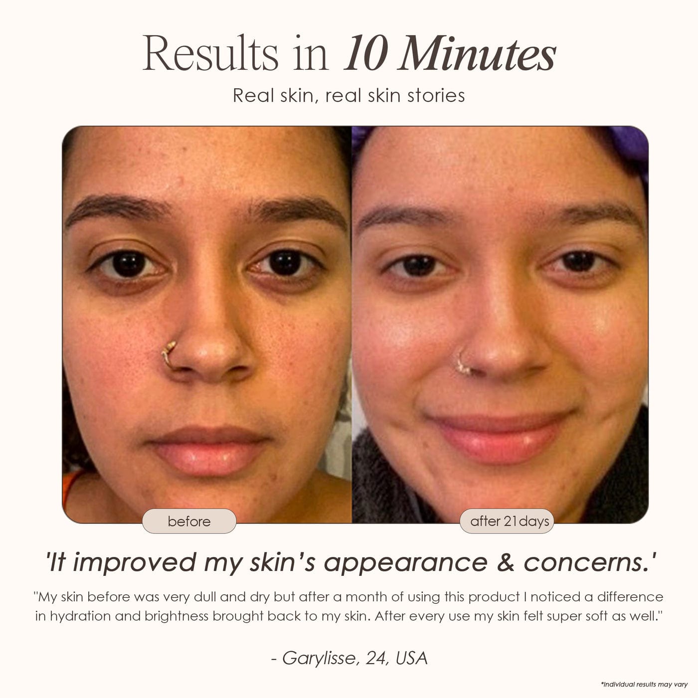 Experience rejuvenated skin with the Nano Ionic Facial Steamer by Sensa. Achieve professional results at home for confidence and radiance effortlessly.