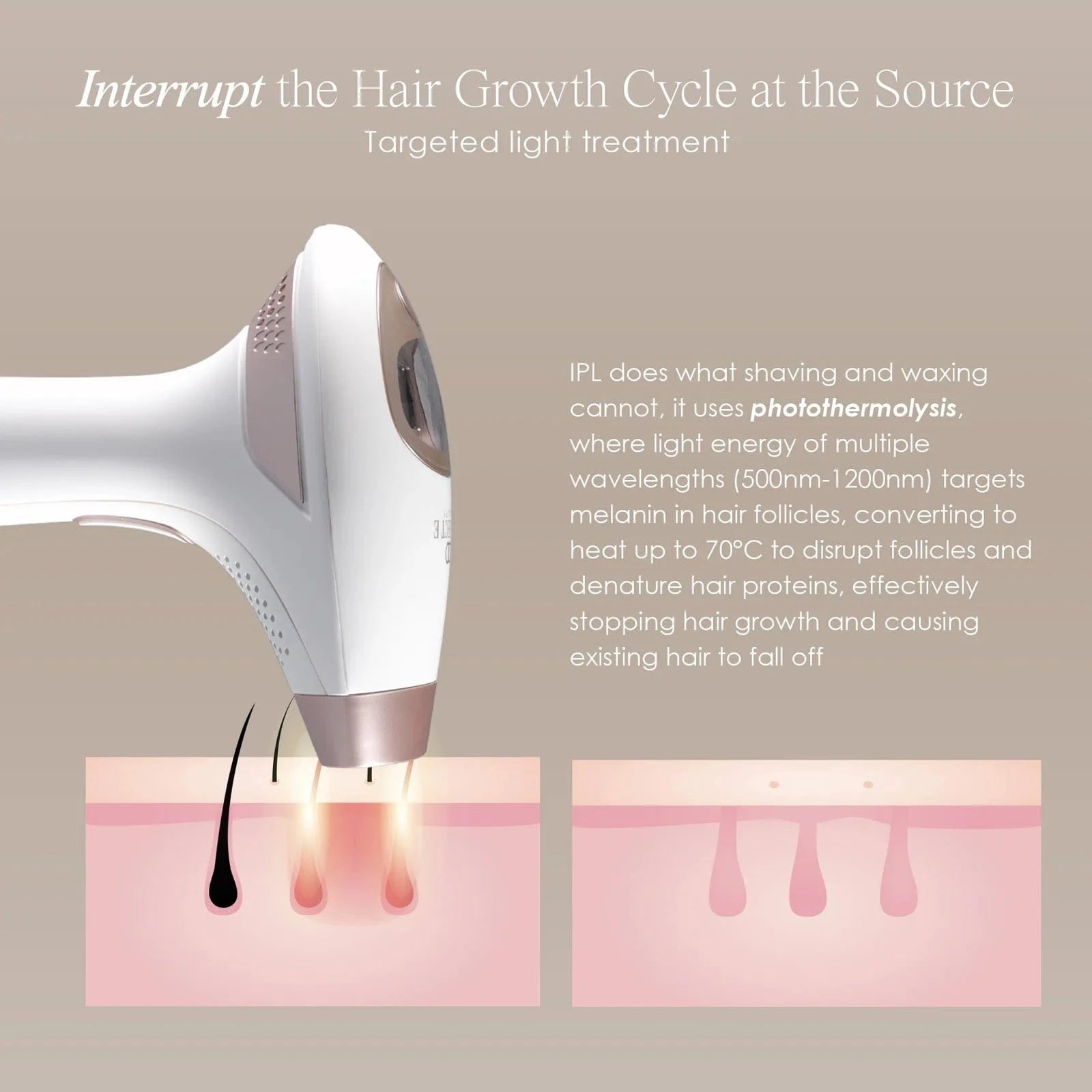 Shop SmoothPro+ IPL Hair Removal Device at Reverie Luxe. Achieve silky-smooth, hair-free skin with safe, painless, and long-lasting IPL technology at home.