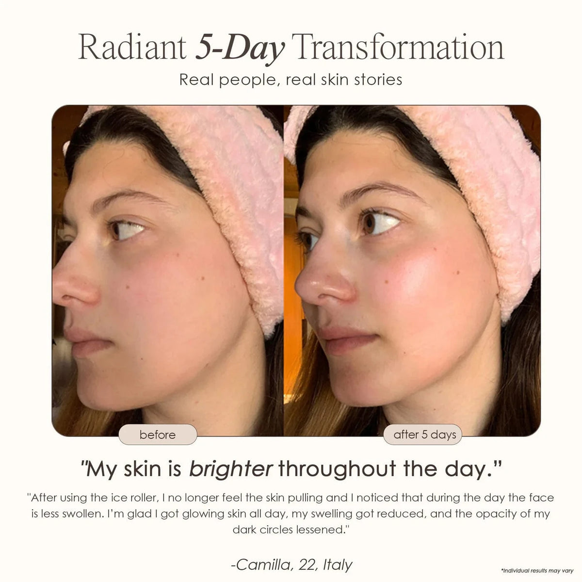 Soothe puffiness, tighten pores & refresh your skin with The Ice Roller | Cryotherapy Treatment. Instant cooling relief for face & body. Shop now.