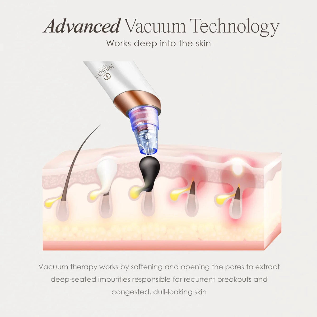 Transform your skincare with the Vana Blackhead Removal Vacuum. Effectively remove blackheads and minimize pores for a clearer complexion at home.