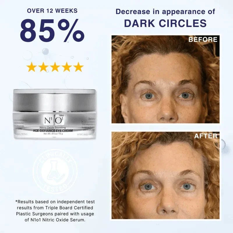 N¹O¹ Age-Defiance Eye Cream in a 15g silver jar, designed to reduce puffiness, wrinkles, and dark circles with nitric oxide boosting formula.