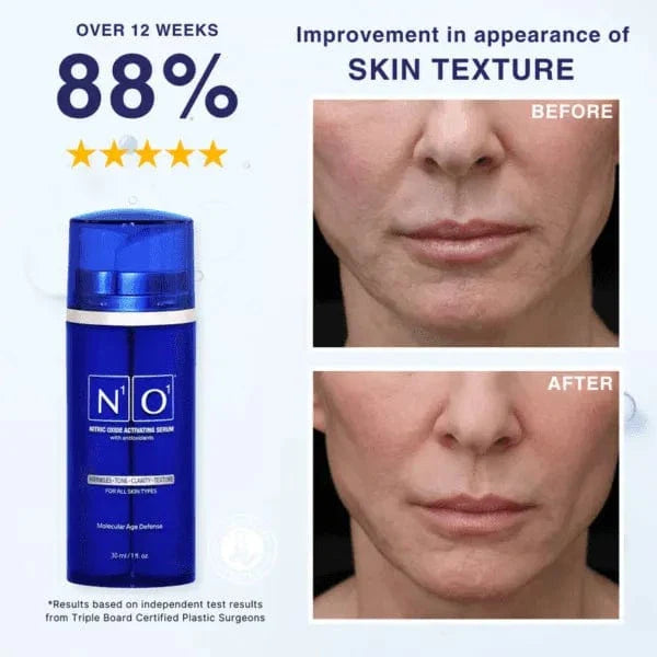 Age-Defiance Serum - Rejuvenate Skin | Reduce Wrinkles with Nitric Oxide and Vitamin C in a 30ml blue bottle for all skin types.