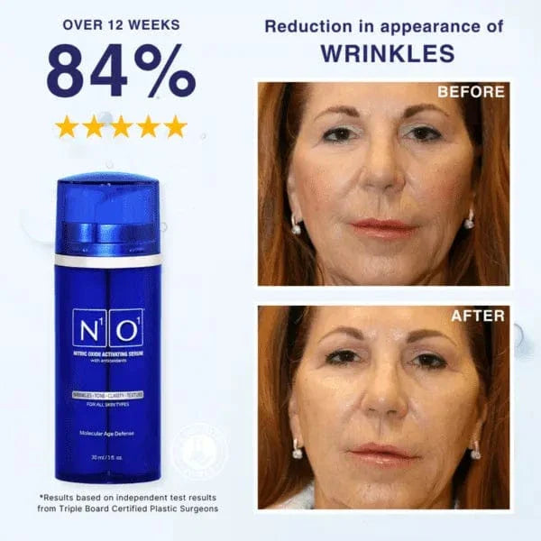 Age-Defiance Serum - Rejuvenate Skin | Reduce Wrinkles with Nitric Oxide and Vitamin C in a 30ml blue bottle for all skin types.