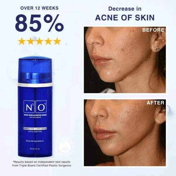 Age-Defiance Serum - Rejuvenate Skin | Reduce Wrinkles with Nitric Oxide and Vitamin C in a 30ml blue bottle for all skin types.