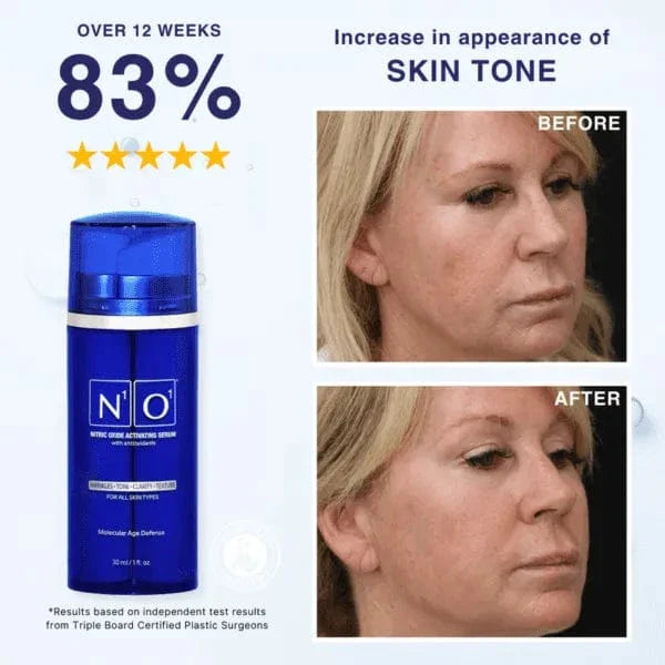 Age-Defiance Serum - Rejuvenate Skin | Reduce Wrinkles with Nitric Oxide and Vitamin C in a 30ml blue bottle for all skin types.